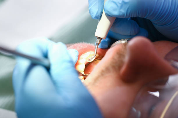 Best Cracked Tooth Emergency Dentist  in Olcott, NY
